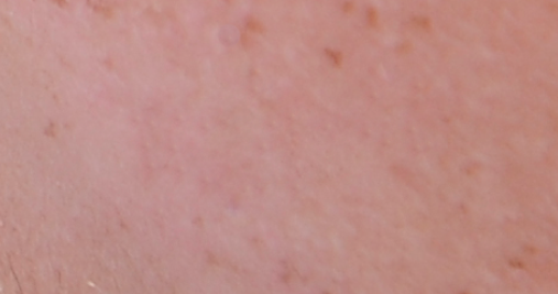 보정 후